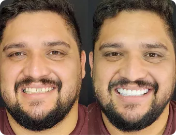 mask-group-3-691caa765afd8