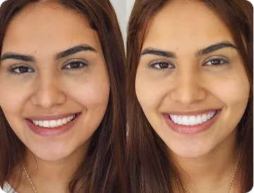 mask-group-691caa7732824